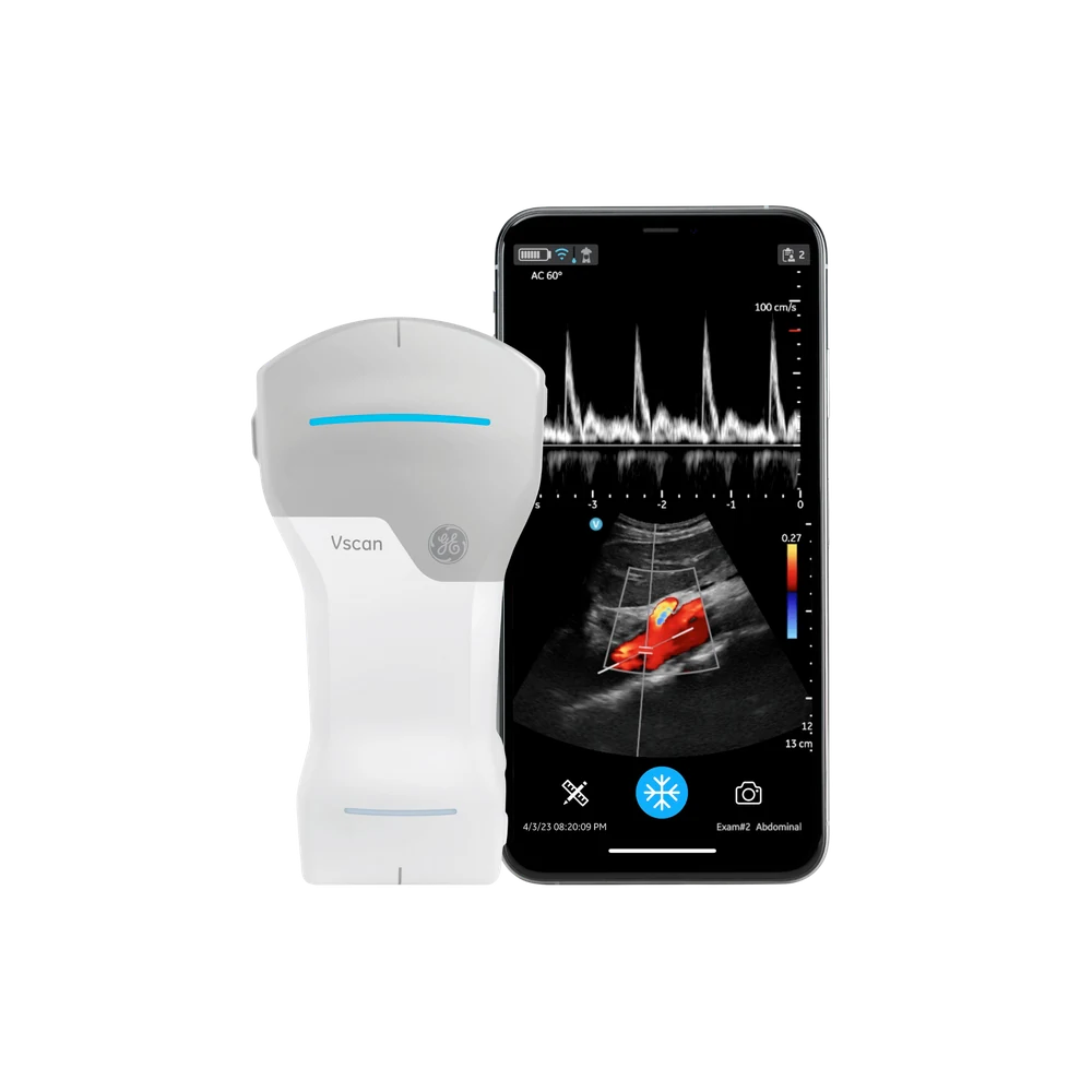 GE Healthcare Vscan Air